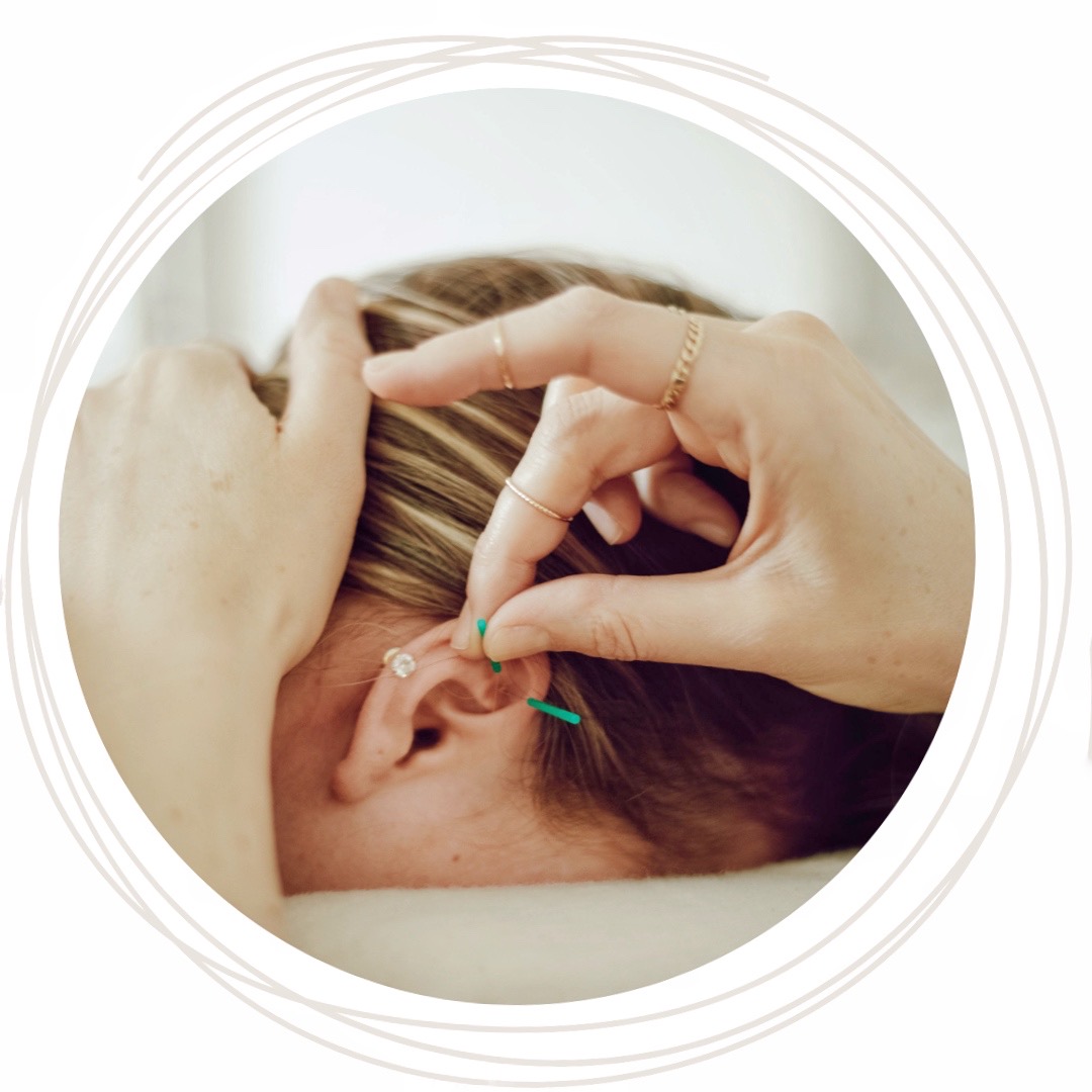 How long does Acupuncture take to work? Shen Medicine Acupuncture