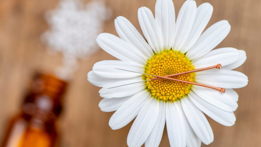 trying to conceive: acupuncture for fertility