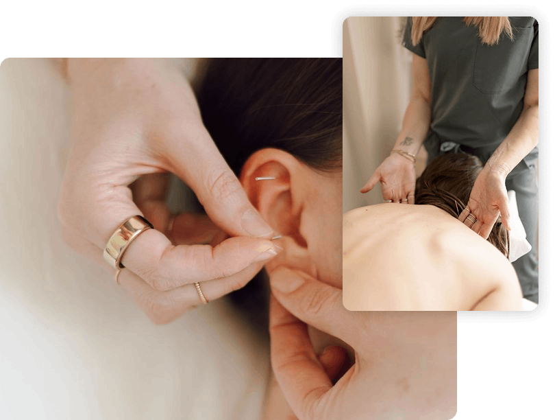 Shen Medicine Acupuncture