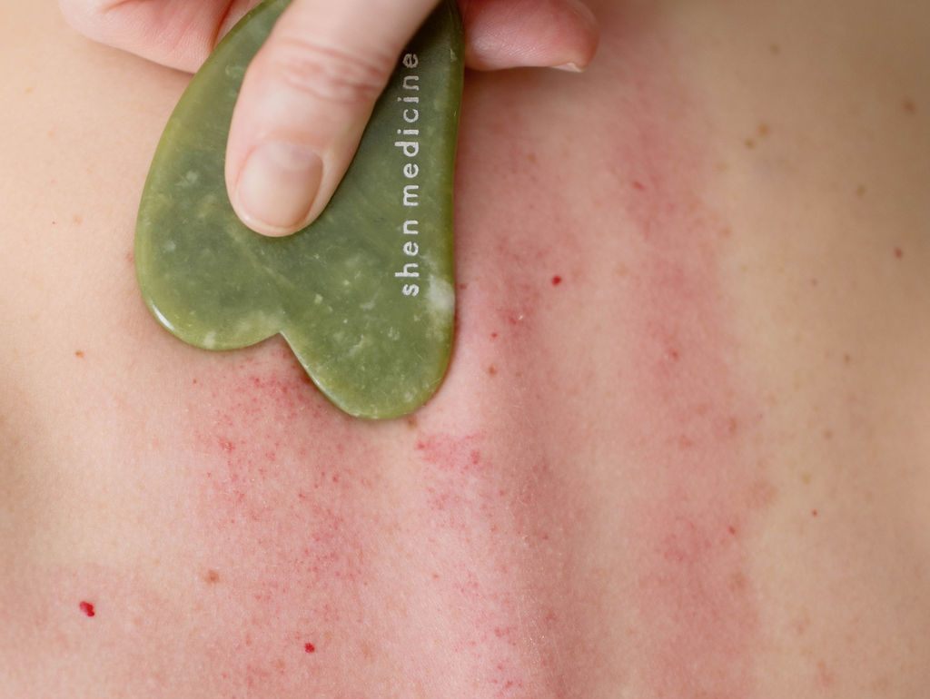 Shen Medicine Acupuncture