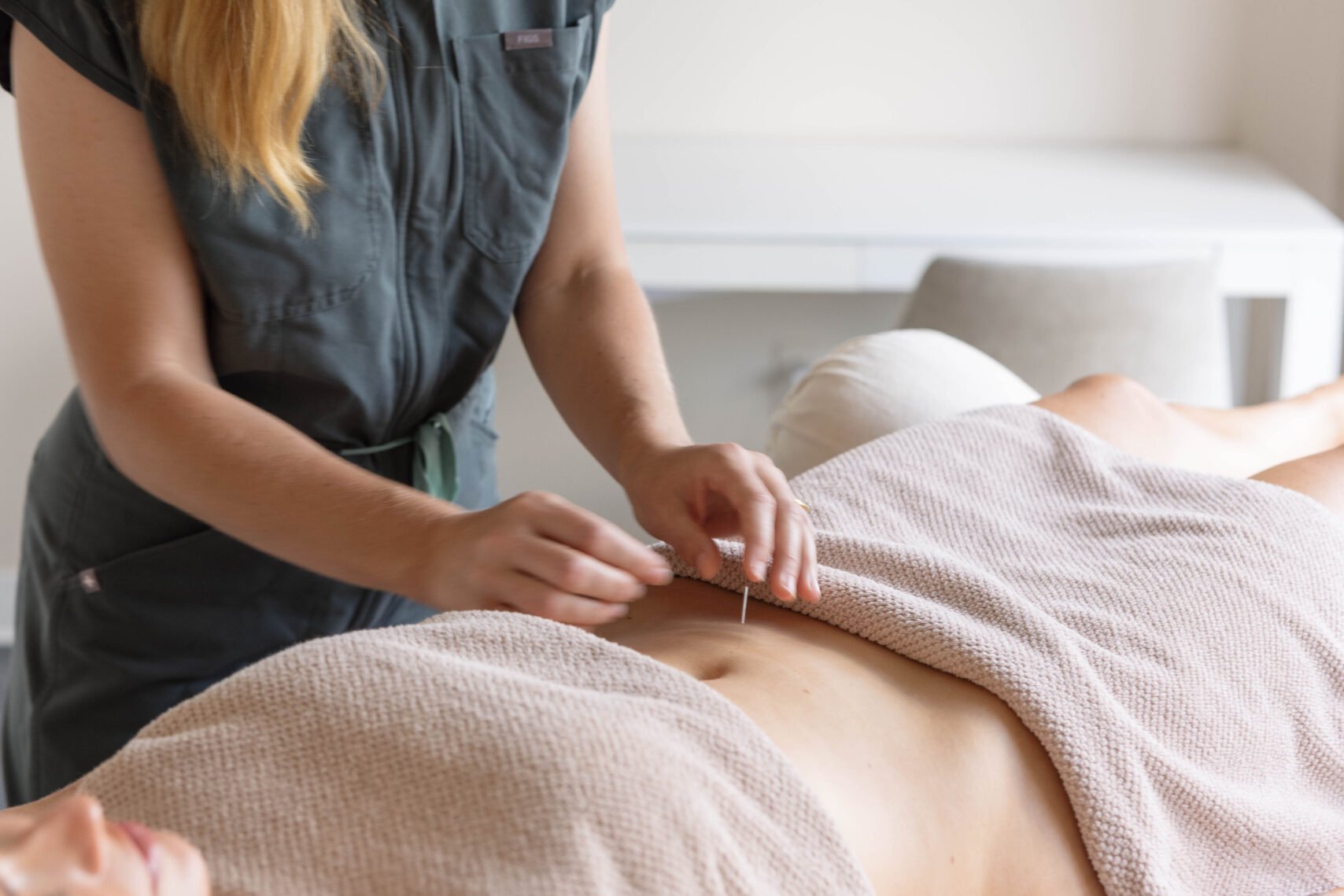 Acupuncturist placing gentle abdominal needles for embryo transfer support at Shen Medicine in Nashville